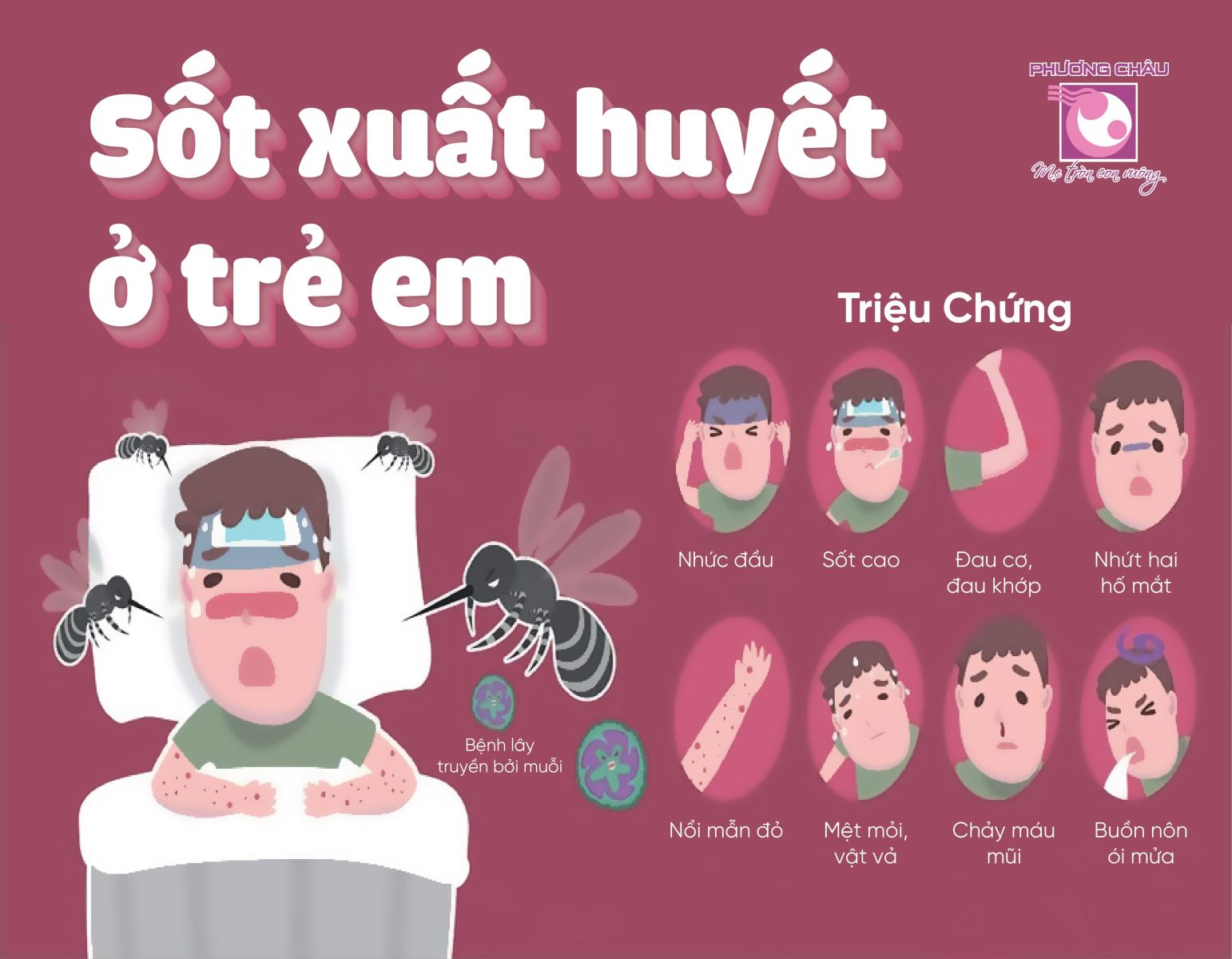  Sốt xuất huyết ở trẻ em 