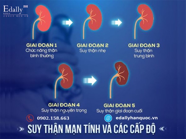 Bệnh thận mạn tính sát thủ thầm lặng cần được nhận diện sớm