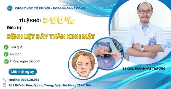 Bệnh Liệt Dây Thần Kinh Số VII Ngoại Biên (Liệt Mặt Ngoại Biên)