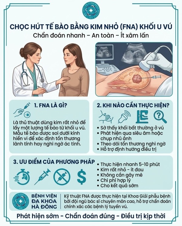 Chọc hút tế bào bằng kim nhỏ khối u vú – Kỹ thuật chẩn đoán nhanh và an toàn tại Bệnh viện Đa khoa Hà Đông