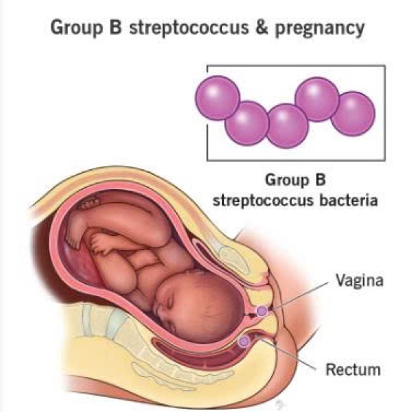 Sàng lọc GBS – Chủ động bảo vệ con ngay từ giây phút đầu đời