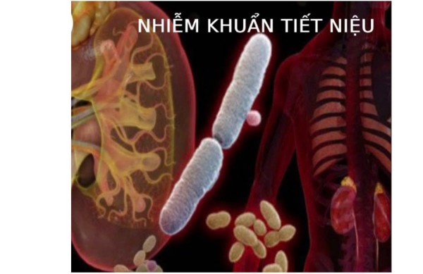 Cập nhật hướng dẫn IDSA 2025 điều trị nhiễm khuẩn tiết niệu phức tạp (CUTI)