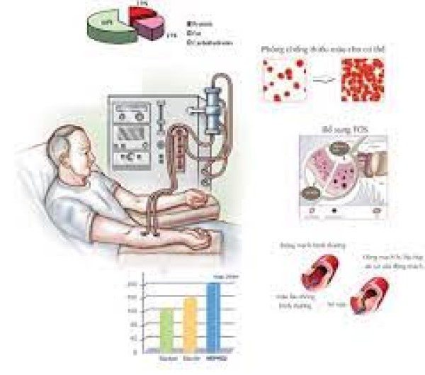 Điều trị thay thế thận bằng thận nhân tạo