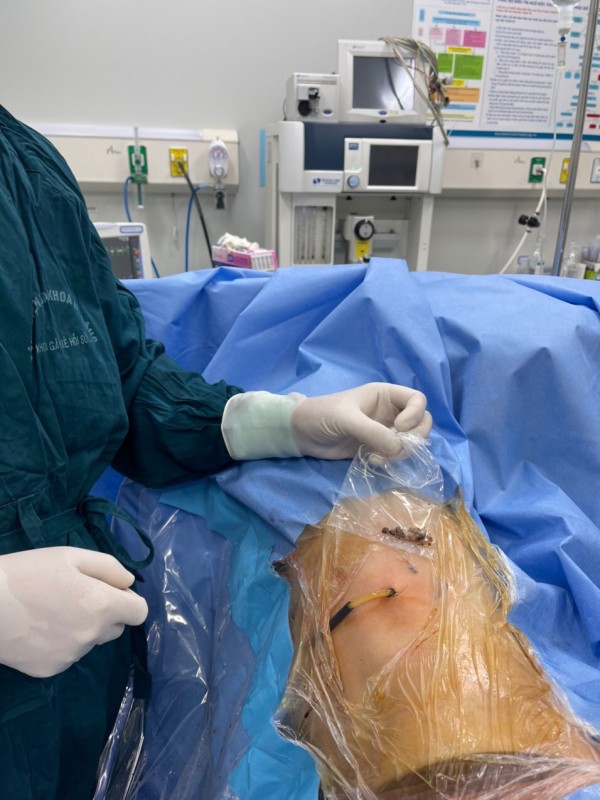 Vai trò của máy laser trong y khoa