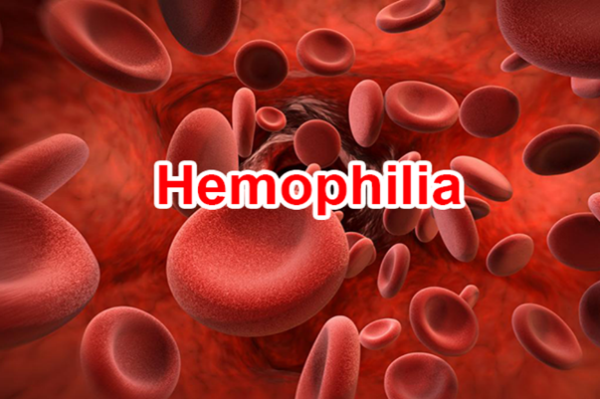 Bệnh Hemophilia ( Bệnh Máu Khó Đông )- Nhận Biết Và Phòng Ngừa