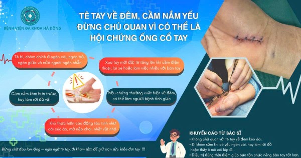 Tê tay về đêm, cầm nắm yếu: Đừng chủ quan vì có thể là hội chứng ống cổ tay