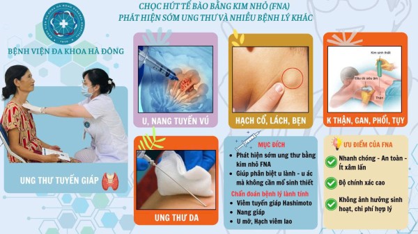 Chọc hút tế bào bằng kim nhỏ (FNA)  phát hiện sớm ung thư và nhiều bệnh lý khác