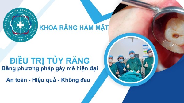 Điều trị tủy răng bằng phương pháp gây mê