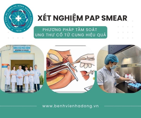 Xét nghiệm PAP Smear – Phương pháp tầm soát ung thư cổ tử cung hiệu quả