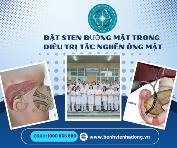 Đặt stent đường mật can thiệp hiện đại trong điều trị tắc nghẽn ống mật tại đơn nguyên can thiệp mạch - Bệnh viện Đa khoa Hà Đông